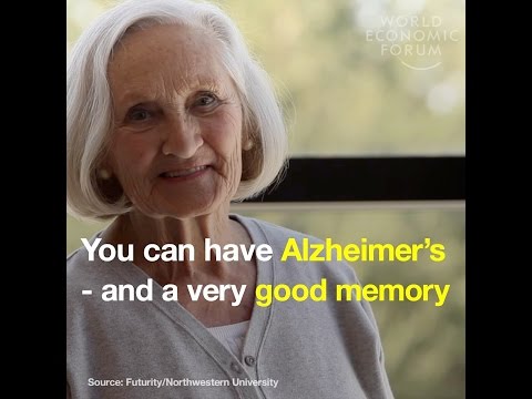 You can have Alzheimer’s   and a very good memory
