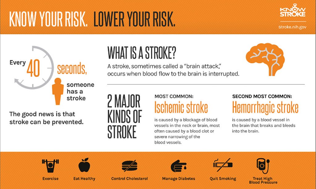 Learn about the two major types of stroke and how to reduce your risk.  …