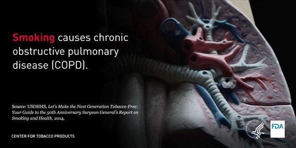 Over 70 chemicals in cigarette smoke can cause cancer. Learn about chemicals & c…