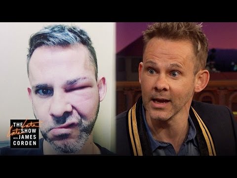 Dominic Monaghan Still Isn’t Afraid of Bees