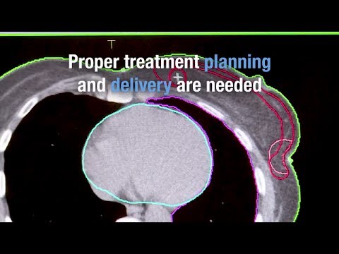 International Conference on Advances in Radiation Oncology (ICARO2) – Trailer