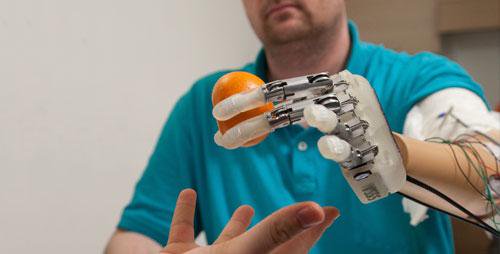 EU supported project enables patients to control artificial arms in real time
