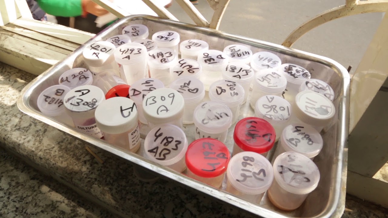 TB: Let’s work on it