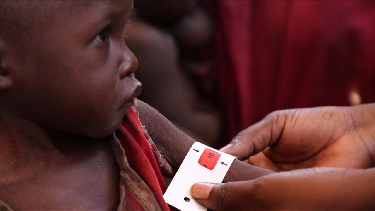 UN: Hunger continues to worsen in war zones