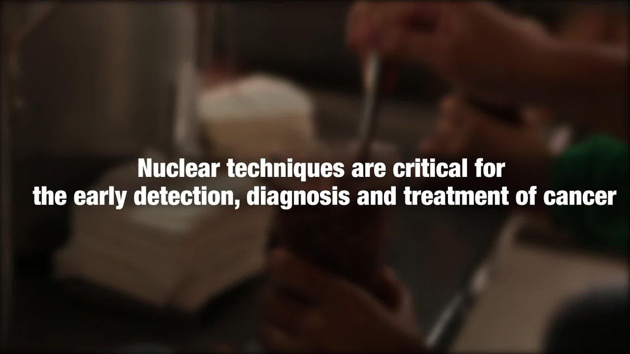 Surviving cancer is possible – International Atomic Energy Agency (IAEA)