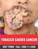 New Specified Health Warning on Tobacco Products packs