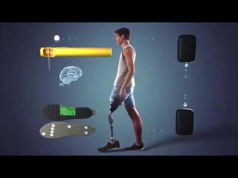 SensAgain – restoring sensations from missing limbs