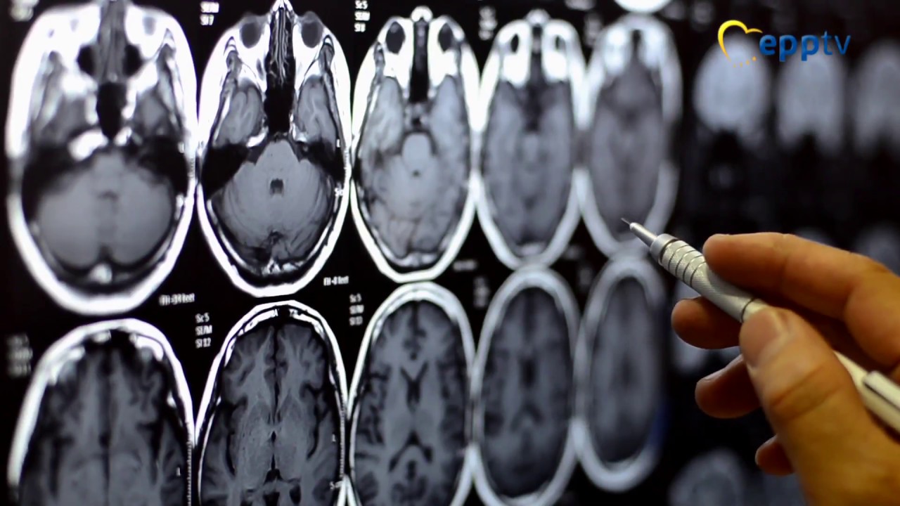 EPP Group leading the drive for action against cancer